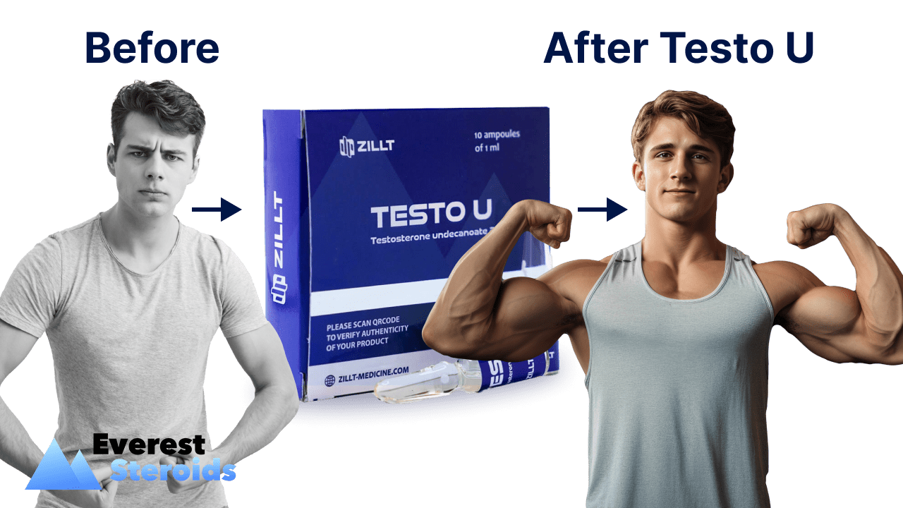 Testosterone Undecanoate before and after